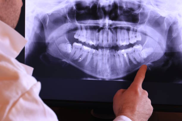 Best Weekend Emergency Dentist in Saint Davids, PA